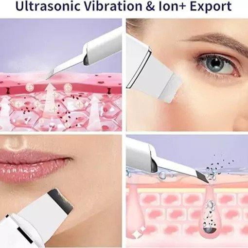 اسکرابر پوست برند آنلن اولتراسونیک صورت، پاکسازی صورت با 4 حالت